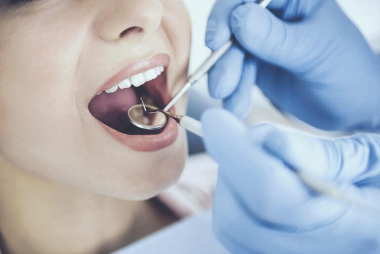 Composite Veneers Implant