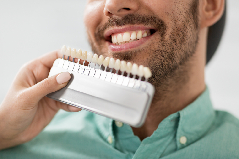 Composite Veneers Service