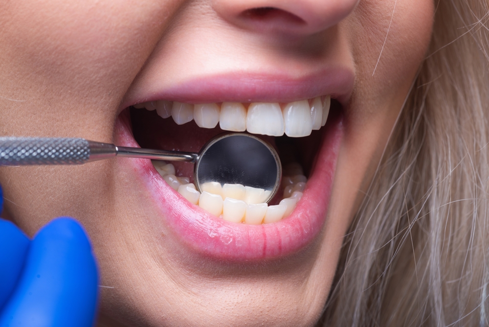 Endodontic Treatment Expert